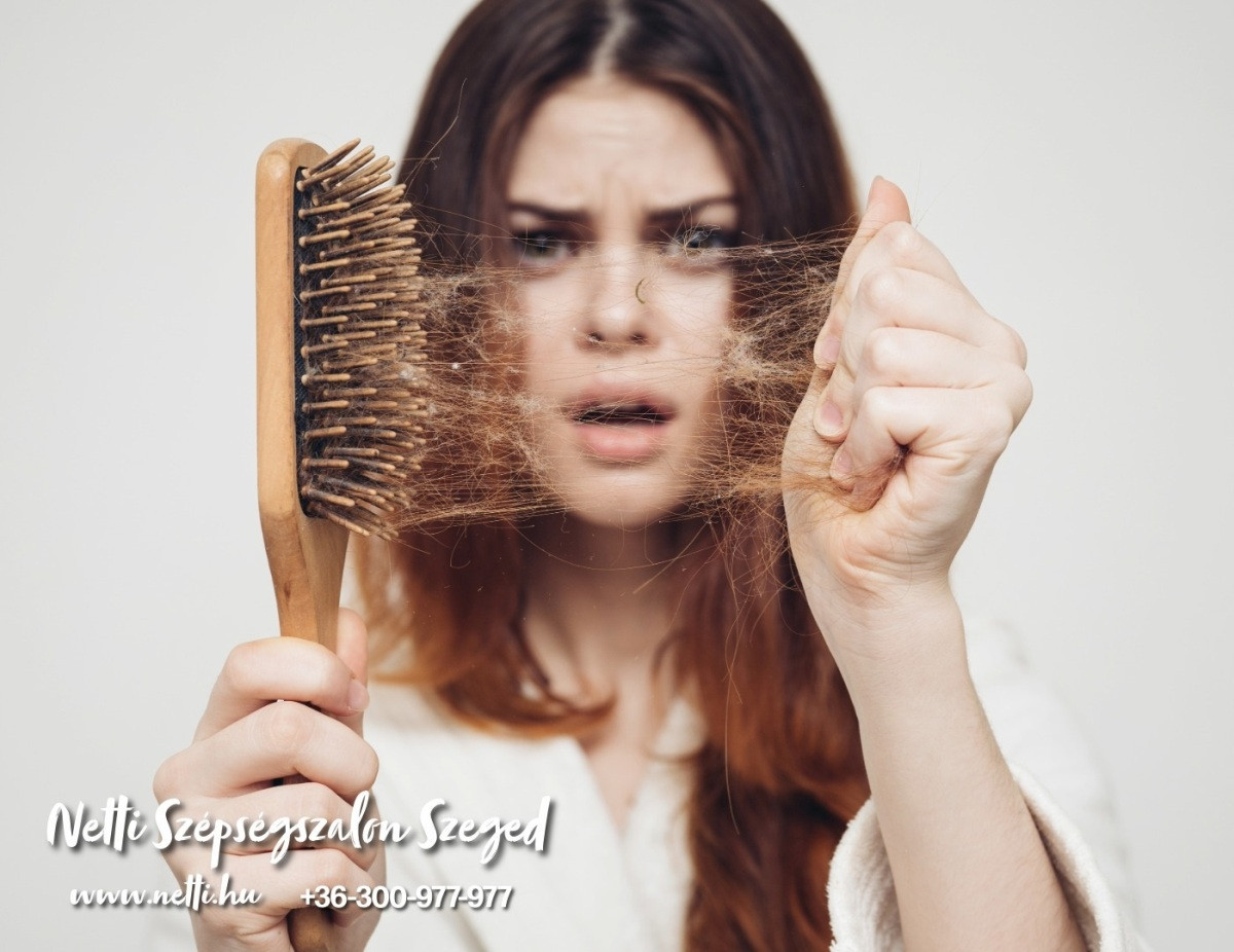 Őszi hajhullás kezelése a Netti Beauty Szépségszalonban Szegeden