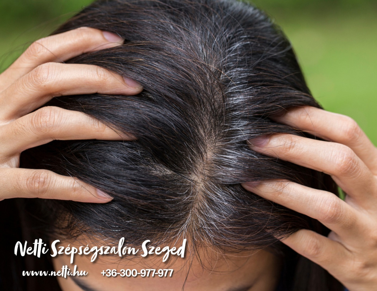 Ősz hajra van megoldás